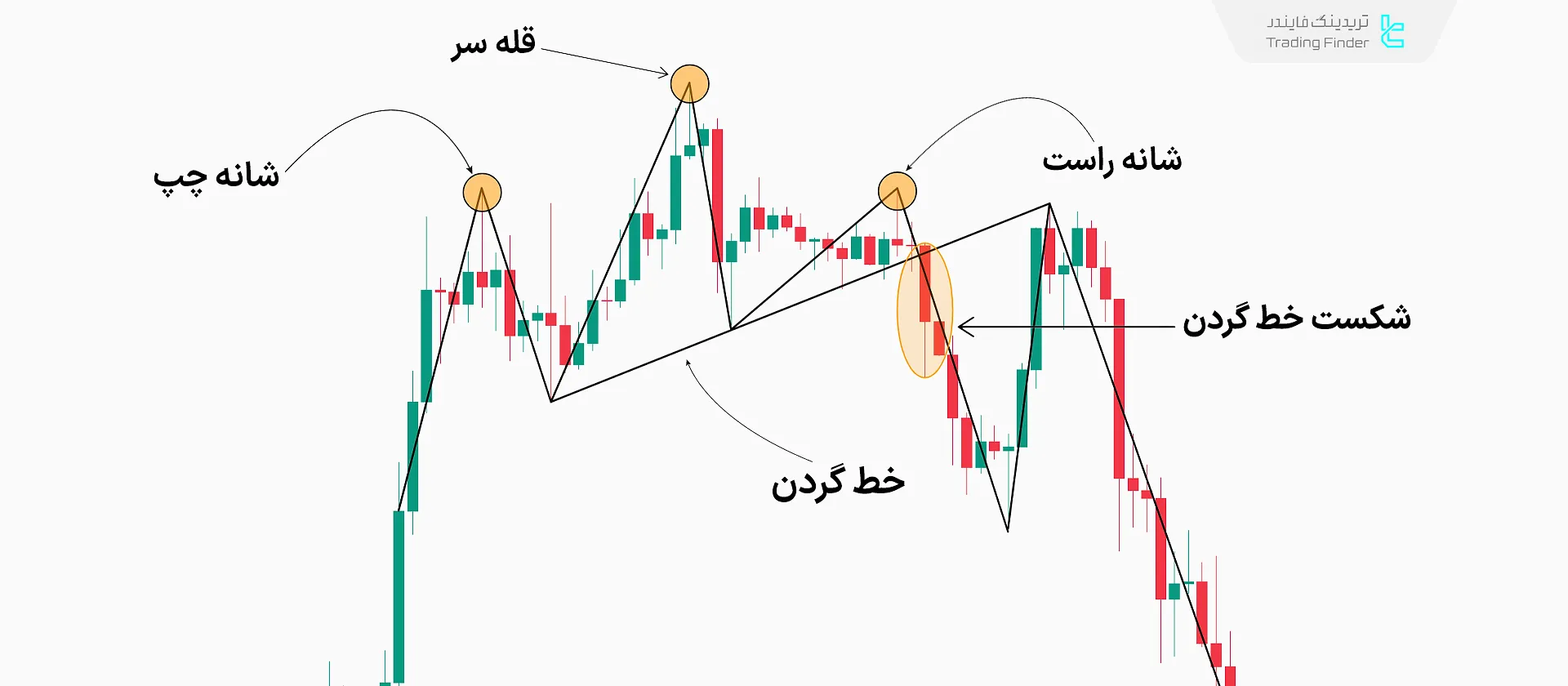 اجزای الگوی سر و شانه
