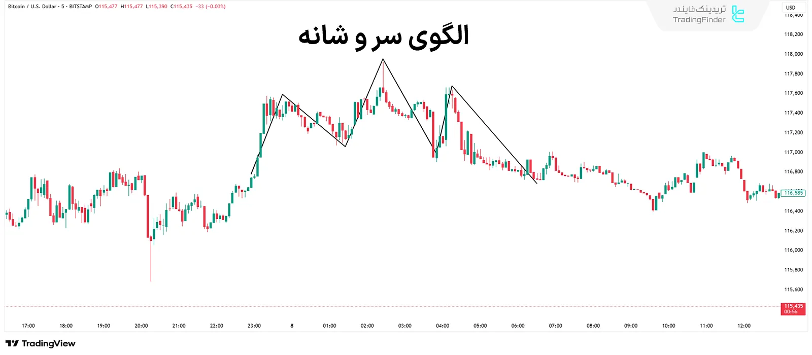 الگوی سر و شانه